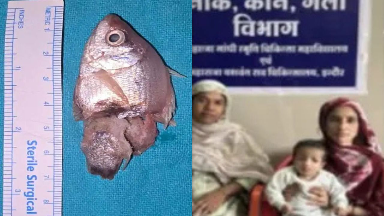 A fish got stuck in the throat of one year old child indore