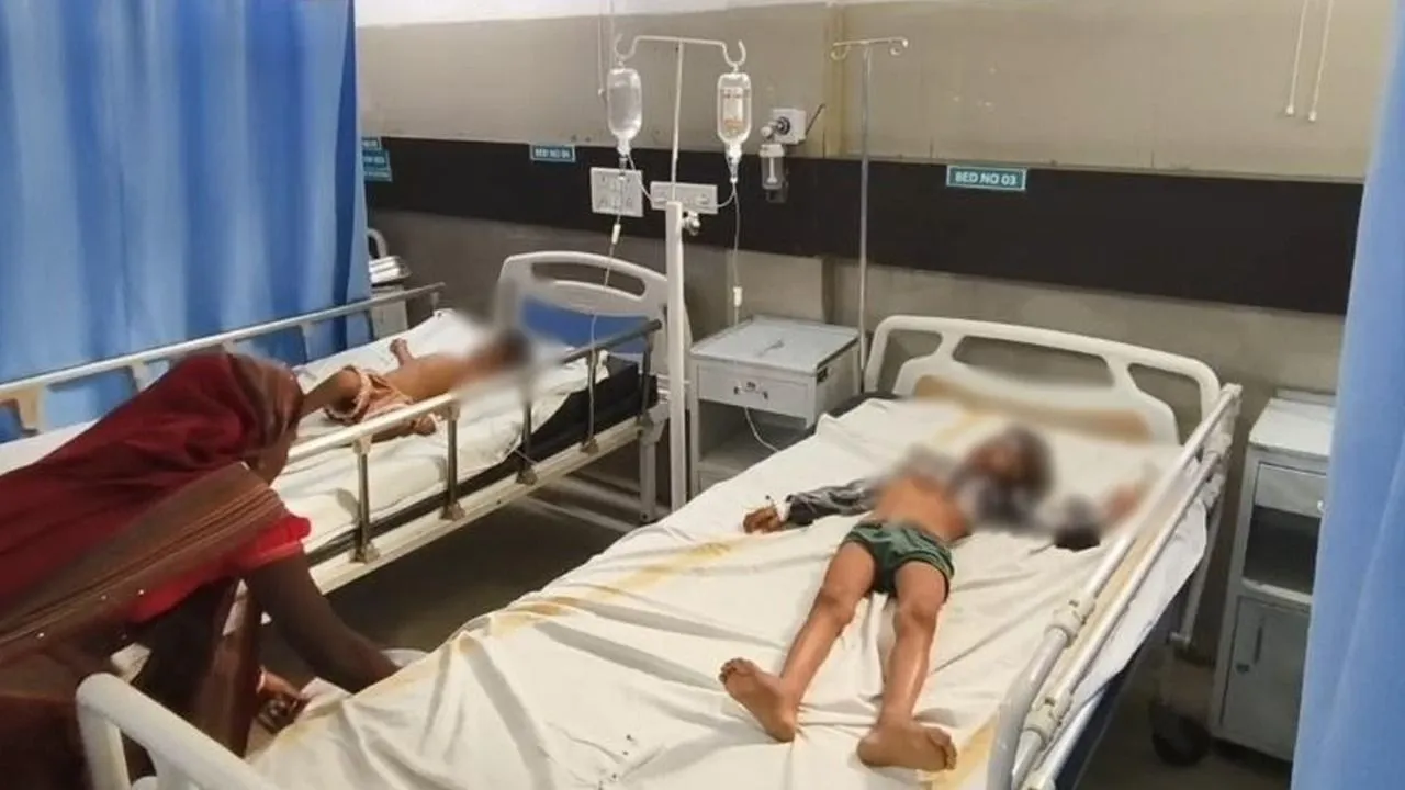 Both the children have been burnt by 50 percent due to acid.