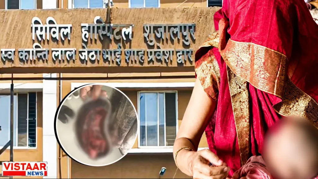 Half a kilo sponge left in woman body after delivery in Shajapur