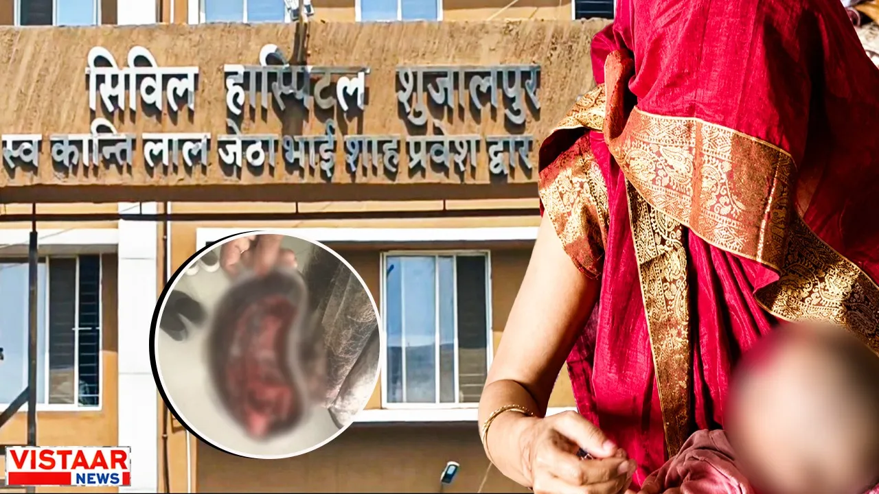 Half a kilo sponge left in woman body after delivery in Shajapur