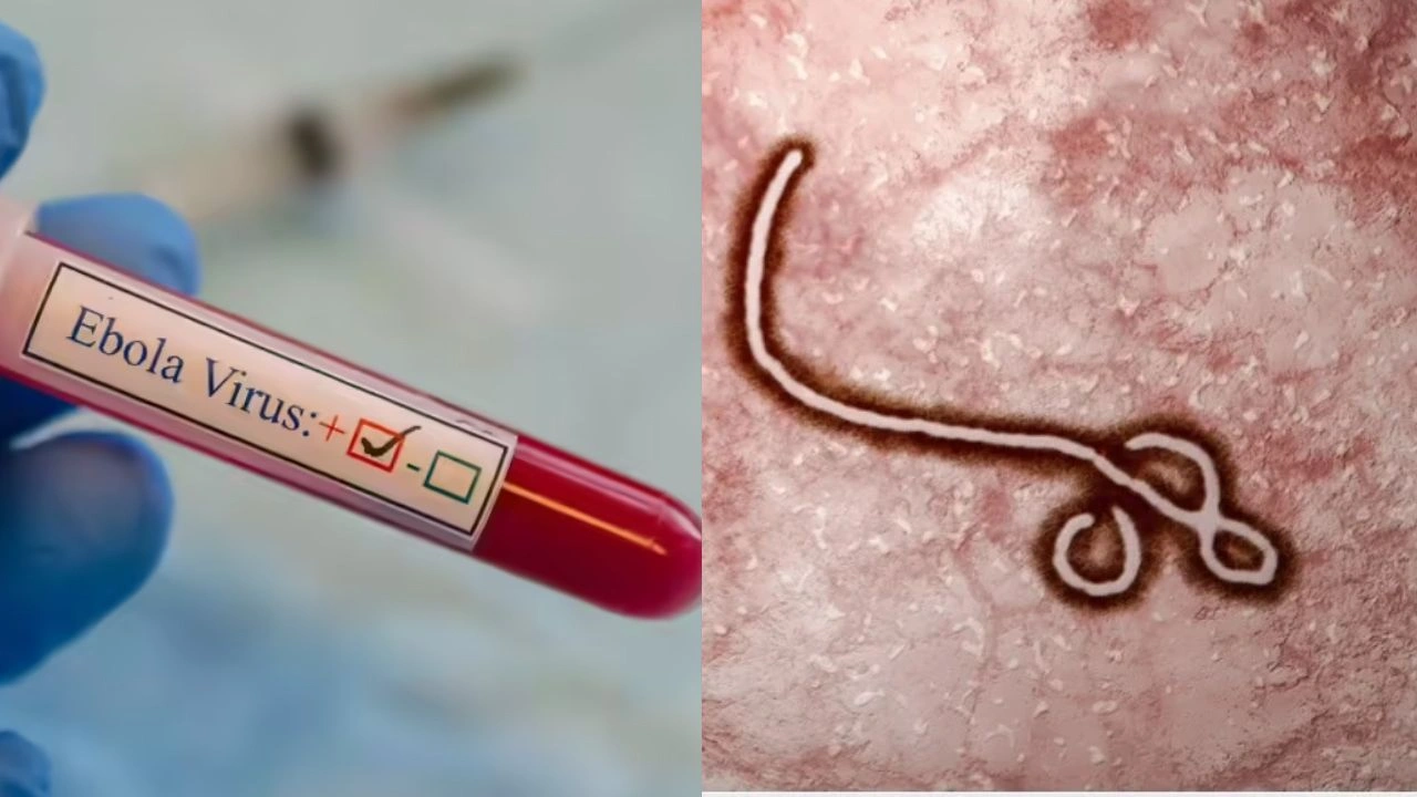 ebola virus