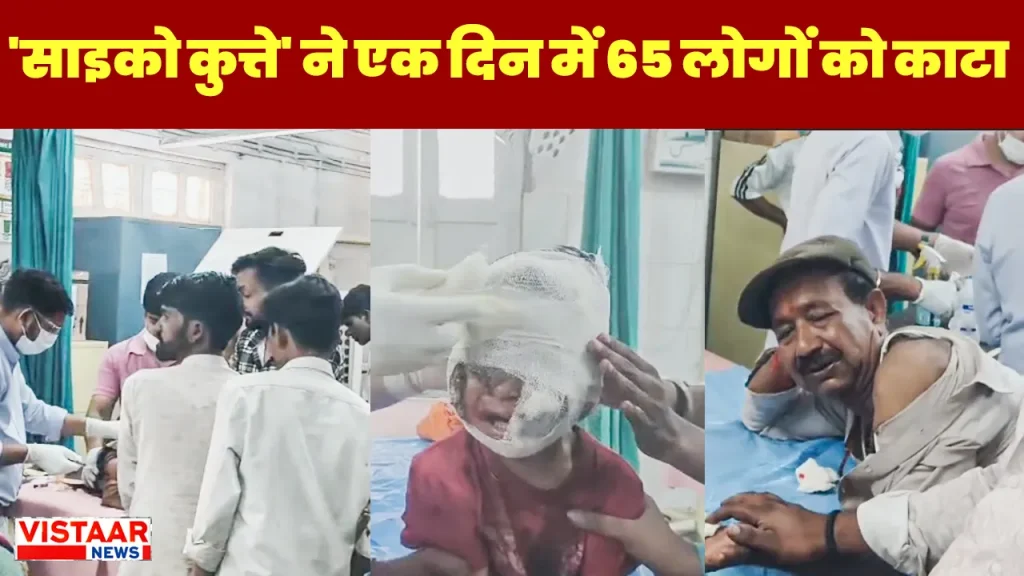 In Shivpuri, a psycho dog attacked 65 people, including a two-and-a-half-year-old innocent, in a single day.