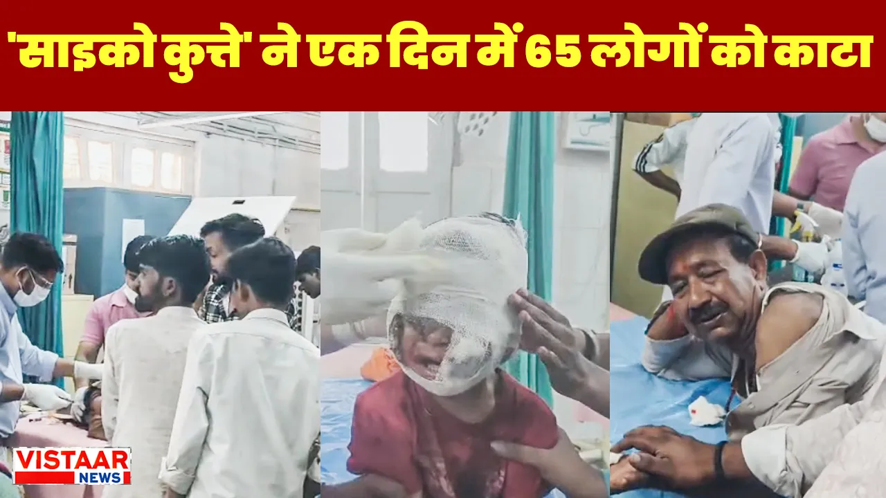 In Shivpuri, a psycho dog attacked 65 people, including a two-and-a-half-year-old innocent, in a single day.